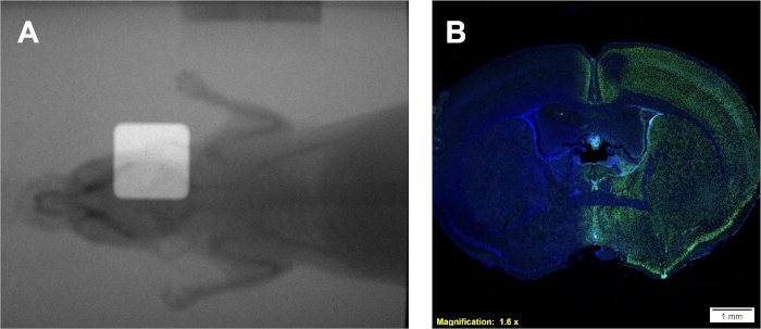 Mouse brain optical imaging; X-ray and fluorescence microscopy, brain structure analysis.