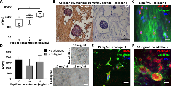 figure-results-4 Box plot, collagen IHC staining, fluorescence microscopy; peptide concentration effects on stiffness.