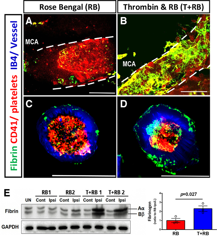 figure-results-2 Immunofluorescence images of fibrin, CD41, IB4 in thrombin, Rose Bengal; associated Western blot results.