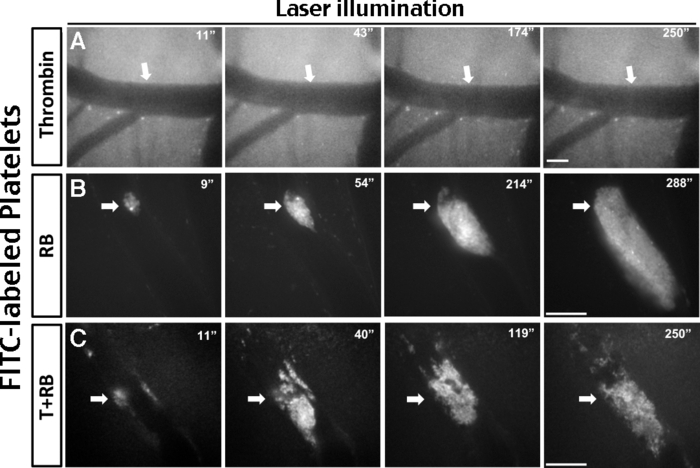 figure-results-3 FITC-labeled platelets under laser illumination; fluorescence microscopy images showing platelet activation.