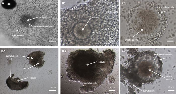 Oocyte maturation stages; microscopy images with labeled cumulus, corona radiata, atretic oocytes.