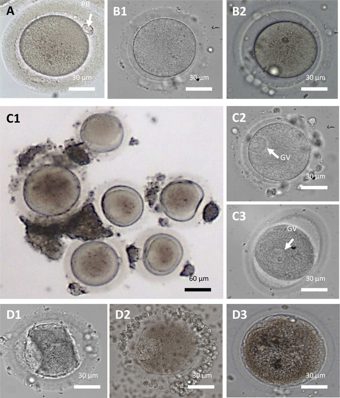Microscope images of oocyte maturation stages; germinal vesicle (GV) identified in some cells.