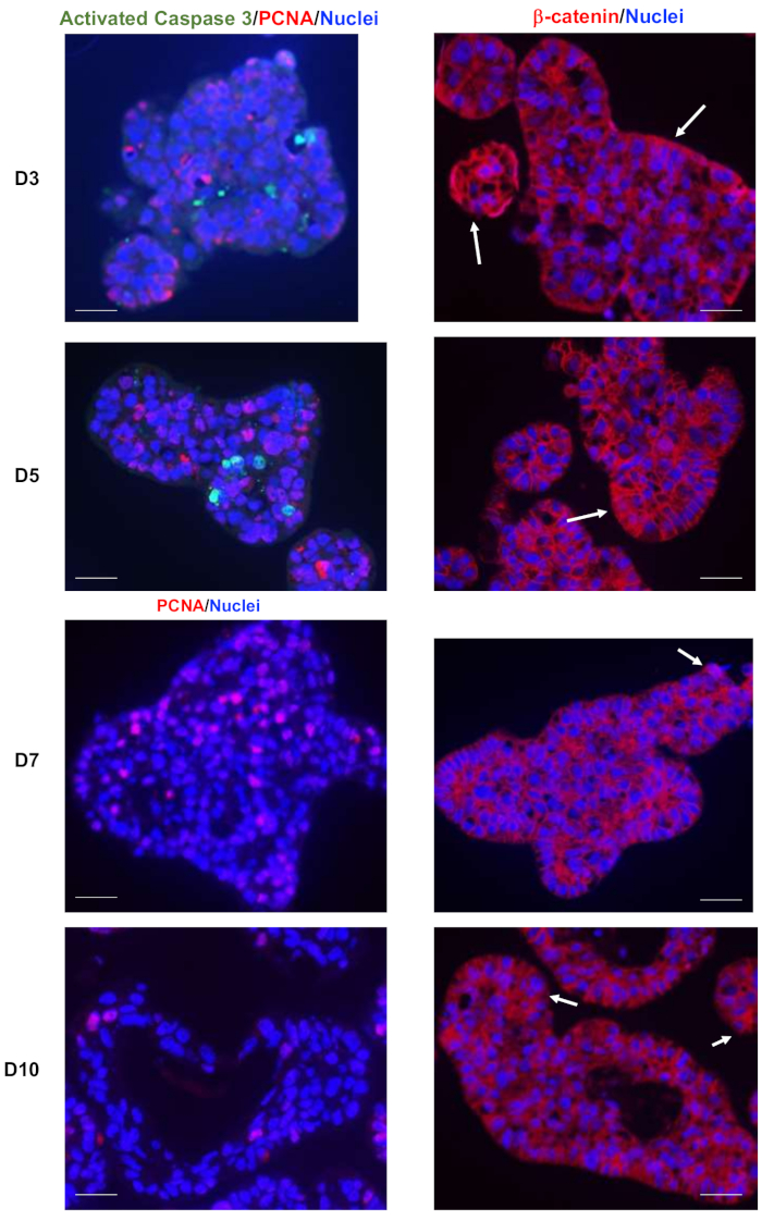 figure-results-4 Immunofluorescence of organoids showing activated Caspase 3, PCNA, β-catenin, and nuclei markers.