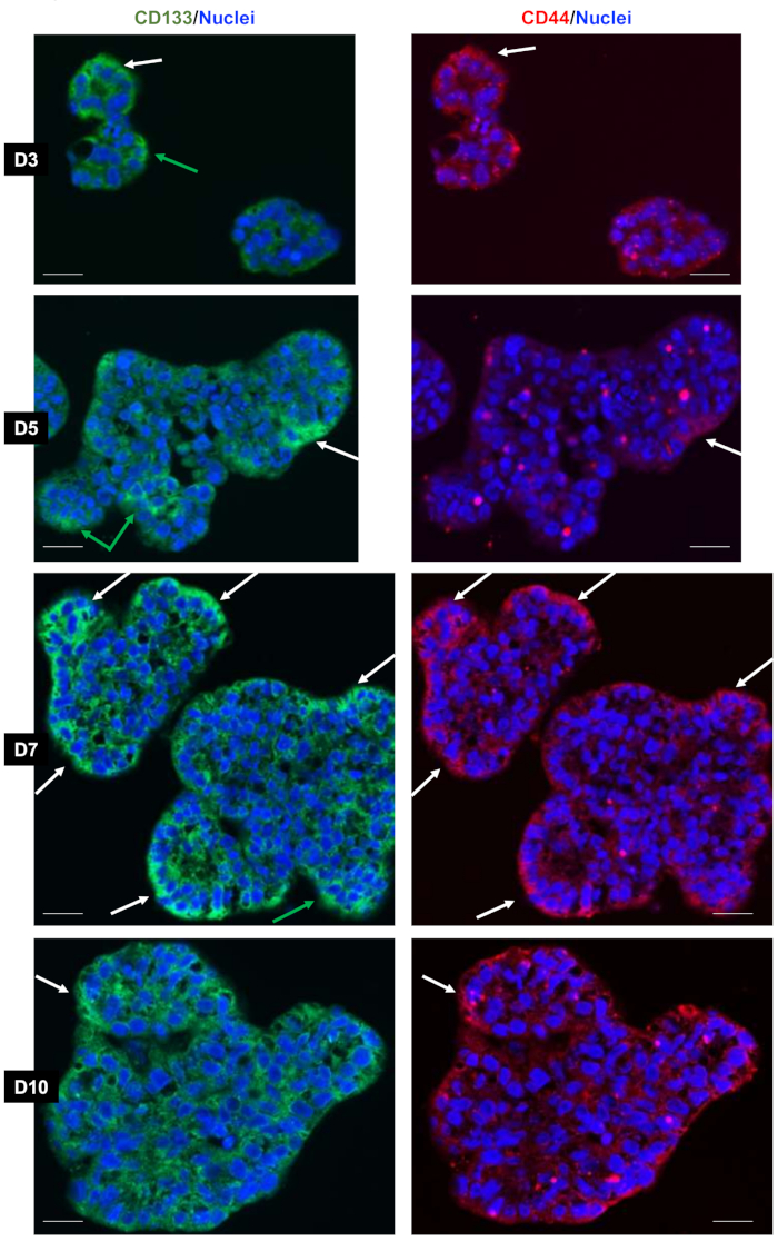 figure-results-6 Immunofluorescence microscopy; CD133/CD44 expression in cell clusters; nuclei stained, tumor marker analysis.