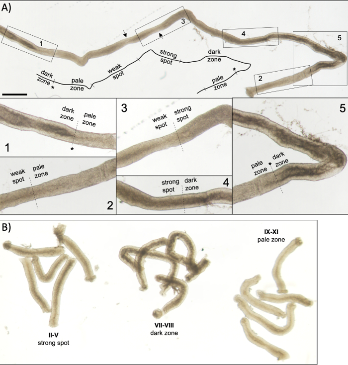 figure-results-5 Segmented worm anatomy diagram; weak, strong spots; pale, dark zones labeled in sections.