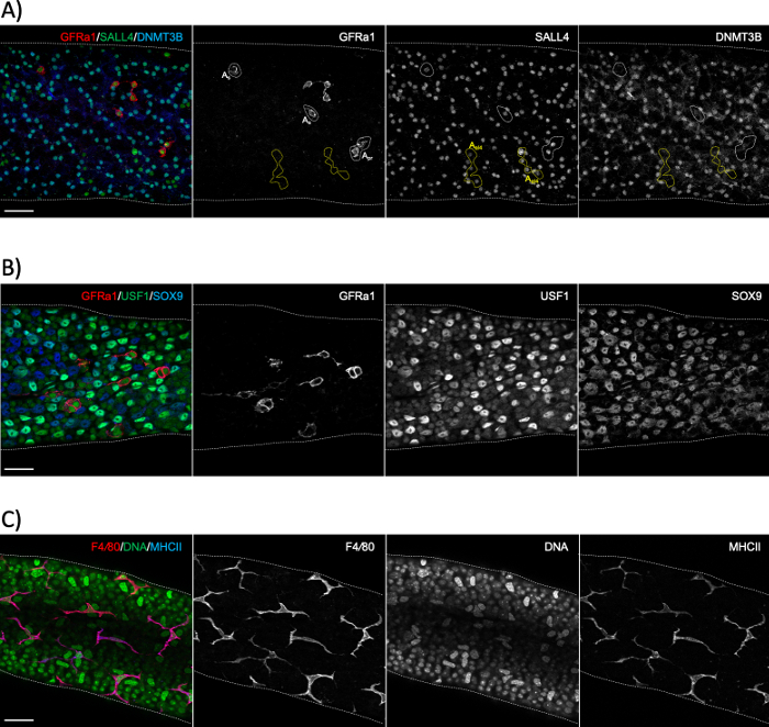 figure-results-6 Immunofluorescence microscopy showing GFRa1, SALL4, DNMT3B, USF1, SOX9, F4/80, DNA, MHCII expression.