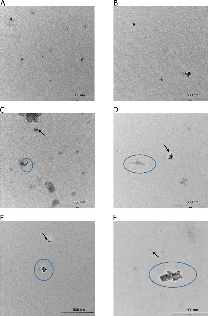 Transmission electron microscopy images, nanoparticle analysis at 500 nm scale.