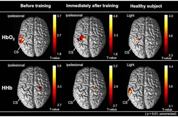 Qualitative and Comparative Cortical Activity Data Analyses from a ...