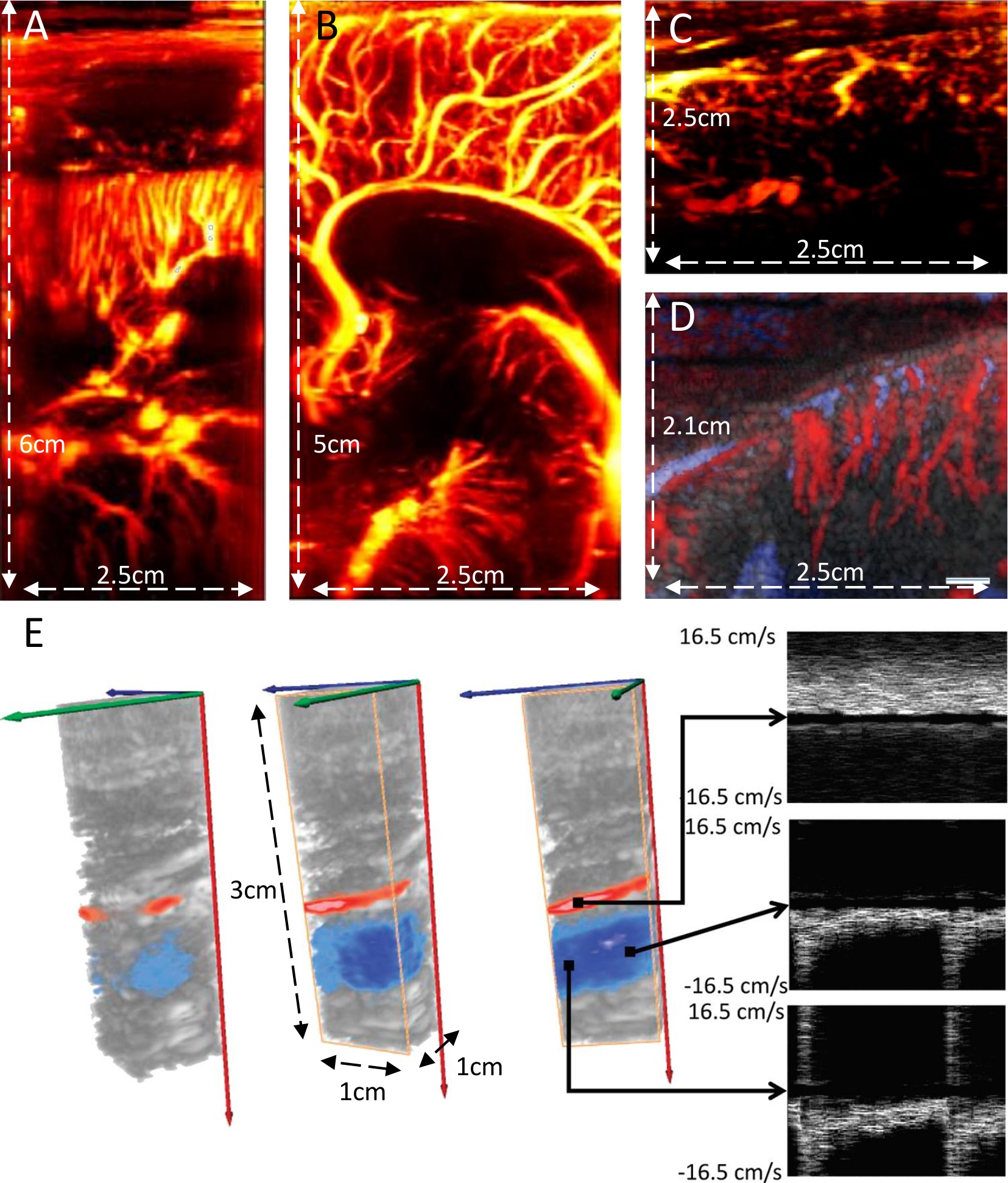 Blood Flow Imaging with Ultrafast Doppler | Protocol (Translated 