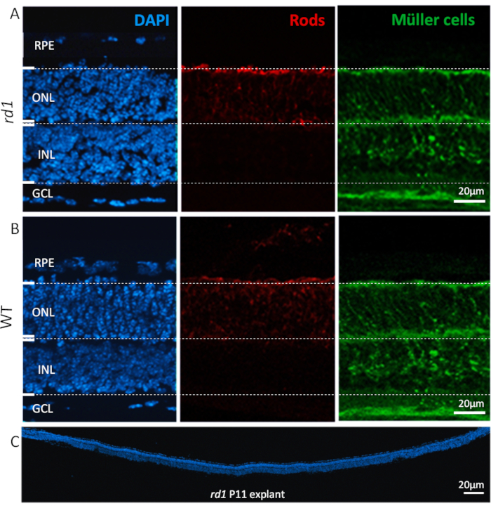 Retinal layers diagram; DAPI staining, rods, Müller cells; microscopy image, tissue structure analysis.