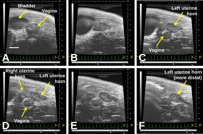 figure-results-2 Ultrasound diagram of uterine horns, bladder, and vagina anatomy.