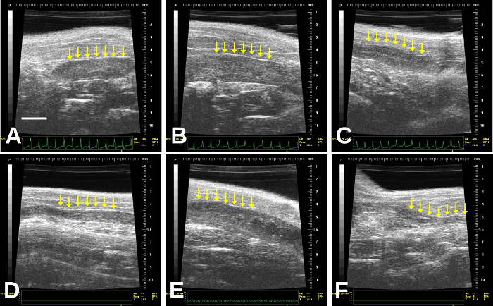 figure-results-3 Ultrasound imaging sequence, muscle analysis, anatomy diagram, yellow arrows indicate muscle patterns.
