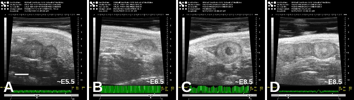 figure-results-5 Ultrasound series, embryonic development, images A-D, gestational age E5.5-E8.5, fetal growth study.