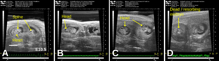 figure-results-7 Ultrasound embryonic development stages, labeled diagram; spine, head, heart marked; E10.5 day.