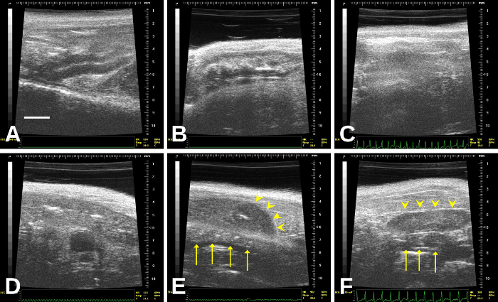 figure-results-9 Ultrasound analysis diagram, six panels showing tissue scans with highlighted areas and arrows.