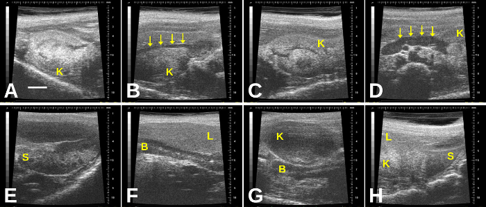 figure-results-10 Ultrasound kidney imaging; multiple perspectives showing anatomical details, potential swelling nodes.
