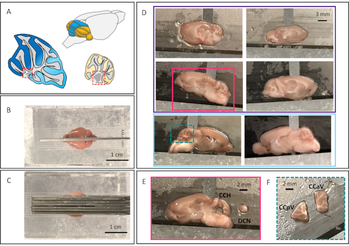 Brain anatomy analysis; diagram and sliced specimen, cross-sectional imaging for structural study.