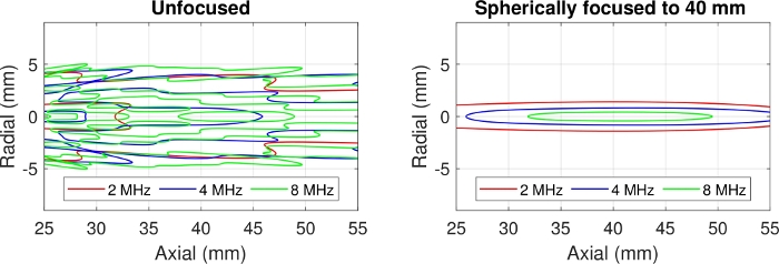 Ultrasound frequency comparison graph; unfocused vs. spherically focused at 40 mm.