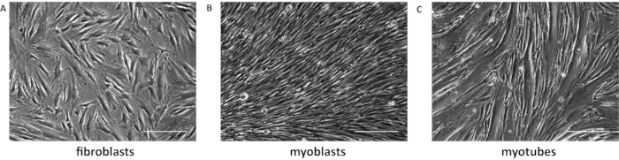 figure-results-3 Fibroblasts, myoblasts, and myotubes in cell culture, microscope image, comparative cell morphology.