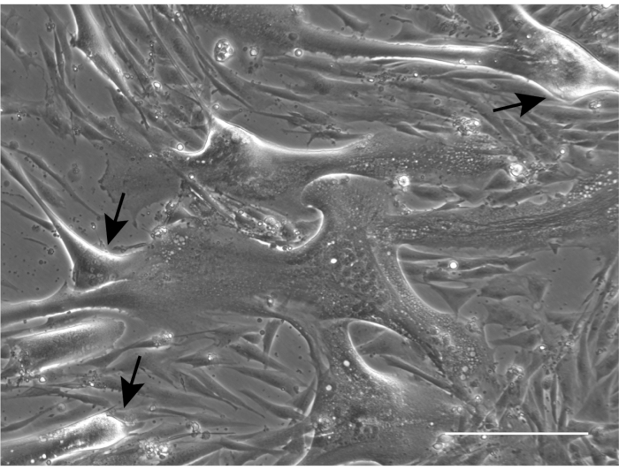 figure-results-4 Microscopy image showing fibroblast cell morphology in culture; arrows indicate cell structures.