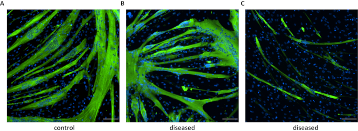 figure-results-5 Fluorescence microscopy of muscle fibers; control vs diseased; cellular structure analysis.