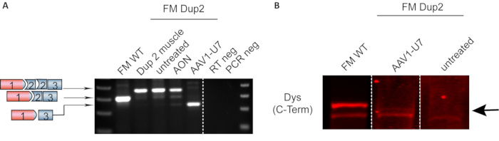 figure-results-7 Gel electrophoresis and fluorescence analysis for DNA Dup2 detection; comparison of treatments.
