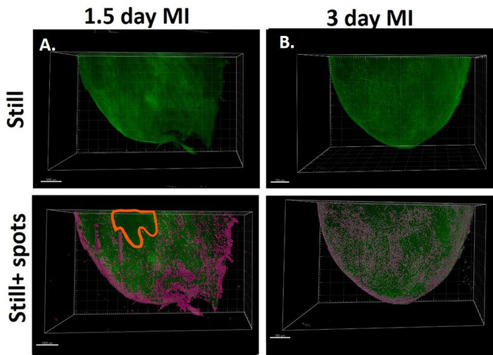 figure-results-5 Cardiac tissue regeneration, 3D microscopy: 1.5-day and 3-day MI analysis showing cellular distribution.