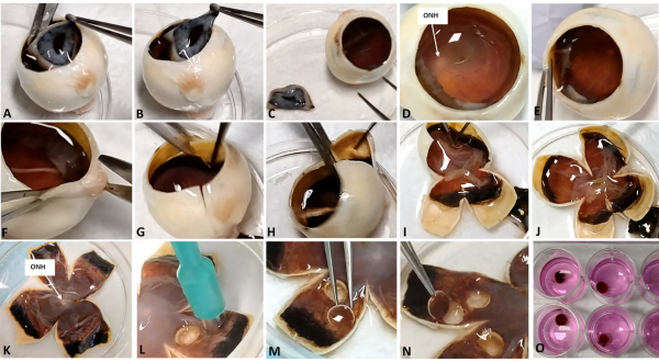 Eye dissection process; step-by-step diagram for anatomical study; tools include forceps, scalpel.