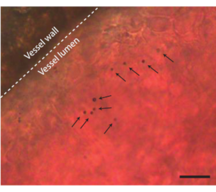 figure-results-8 Microscope image, vessel lumen, wall identification; histological analysis, tissue structure study.