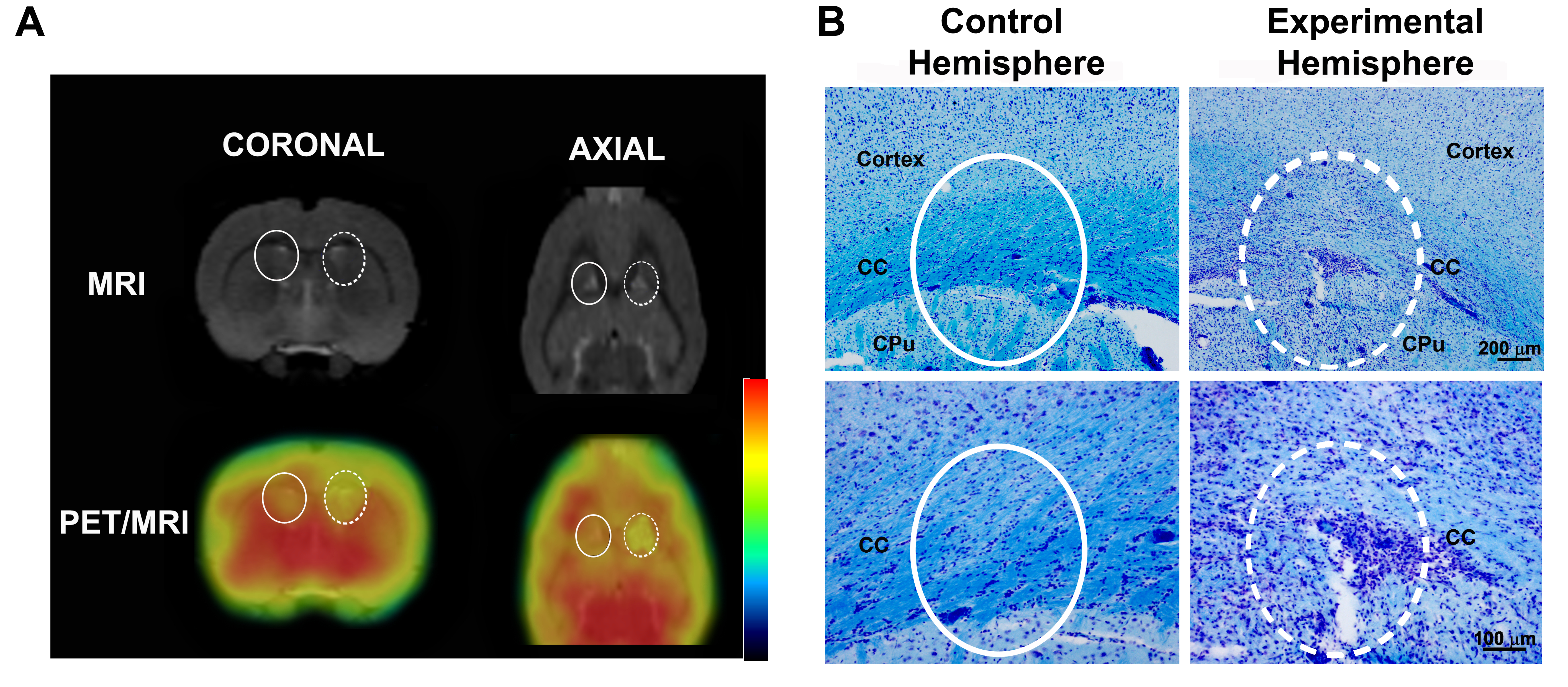 Positron Emission Tomography Imaging for In Vivo Measuring of