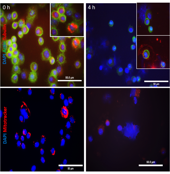 Fluorescence microscopy, DAPI-labeled cells, tubulin-actin mitotracker, cellular imaging.