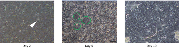 Cell culture growth progression over 10 days; microscope images showing cellular morphology changes.