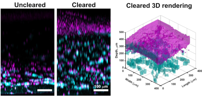 Microscopy imaging comparison, uncleared vs cleared tissue, with 3D rendering for optical clarity analysis.
