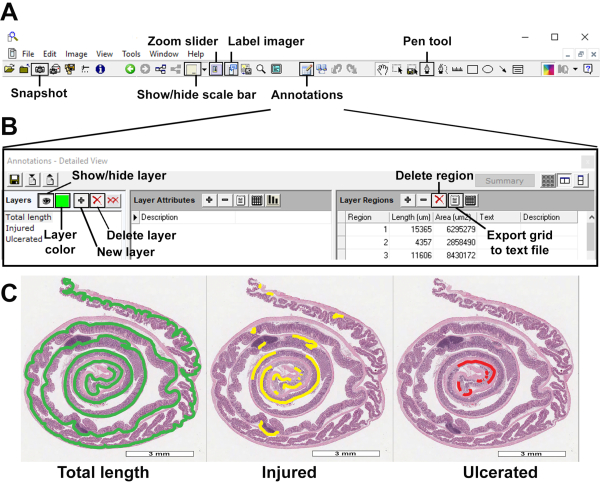 Histological layer analysis; software interface; annotated microscope images of intestinal sections.