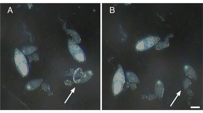 Yeast cell morphology comparison, microscope image, two panels, cell wall integrity analysis.