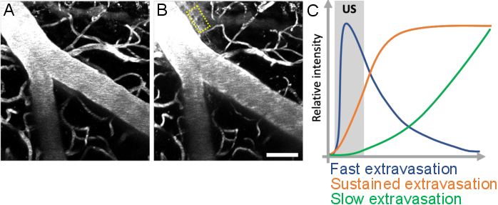 figure-results-10 Extravasation dynamics diagram; vascular microscopy images with intensity graph; fast, sustained, slow.