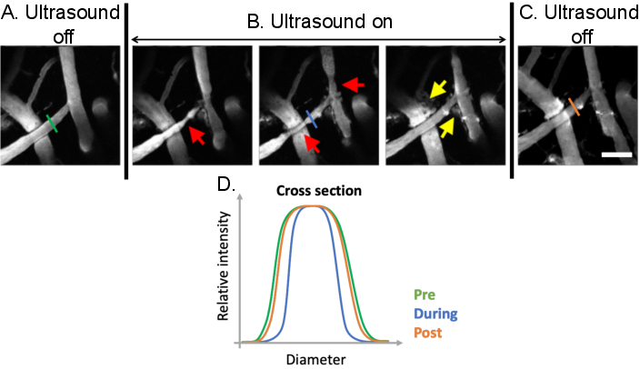 figure-results-9 Ultrasound experiment; vascular imaging analysis; cross-section intensity graph; flow changes.