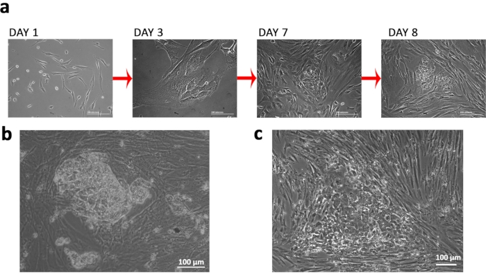 Generation of Induced Pluripotent Stem Cells from Turner Syndrome (45XO ...