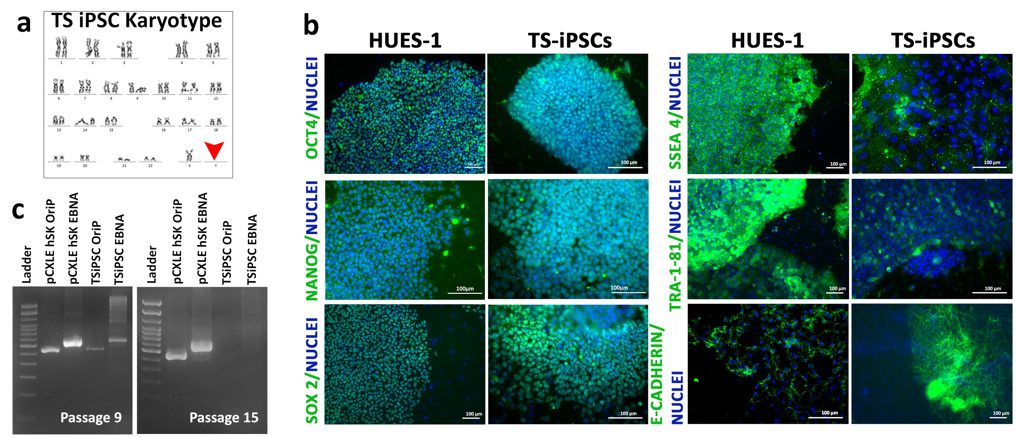 Generation of Induced Pluripotent Stem Cells from Turner Syndrome (45XO ...