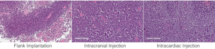 figure-results-2 Histology analysis of tumor cells post-flank implantation, intracranial, and intracardiac injection.