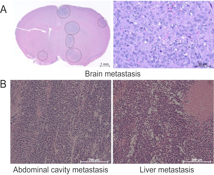 figure-results-3 Histological analysis diagrams of brain, abdominal, and liver metastasis; tissue samples, microscopy.