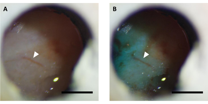 Expérience de fluorescence cornéenne ; Les images microscopiques montrent la fluorescence avant et après l’application du colorant.