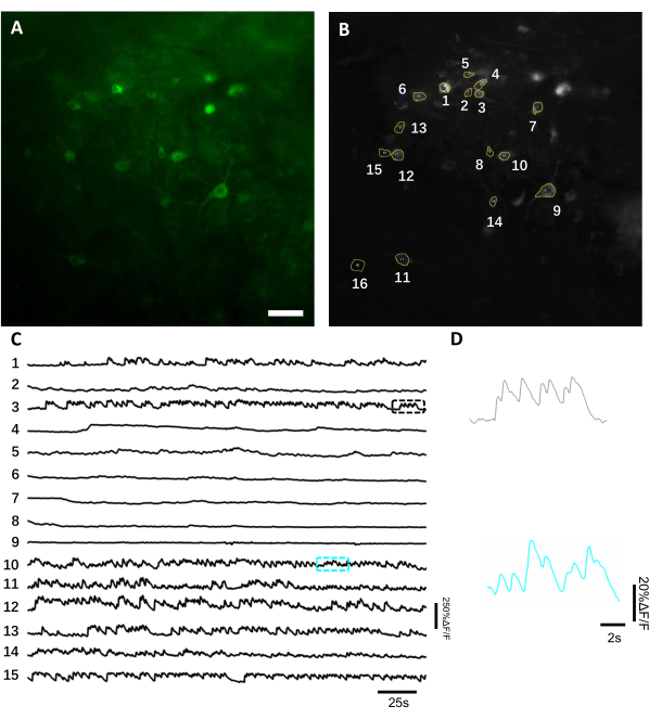 Microscopie à fluorescence, diagramme d’activité neuronale et graphique du signal calcique, présentant l’analyse neuronale.