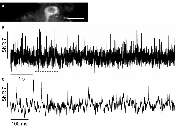 Image au microscope avec graphiques de rapport signal/bruit, analysant la résolution temporelle de l’activité neuronale.