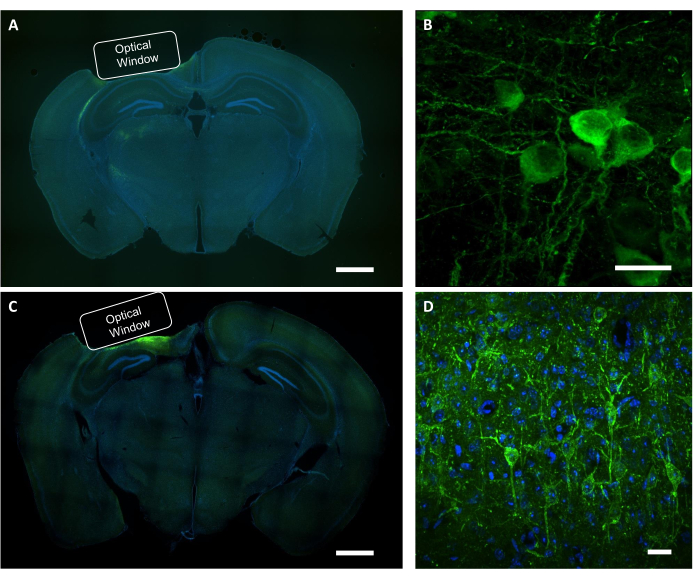 Microscopie à tranches de cerveau ; configuration de la fenêtre optique ; l’imagerie neuronale fluorescente ; Analyse neuroanatomique.
