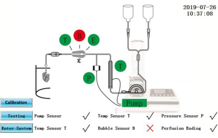 Perfusion system diagram with pump, sensors T, P, B; calibration, testing steps, and errors marked.
