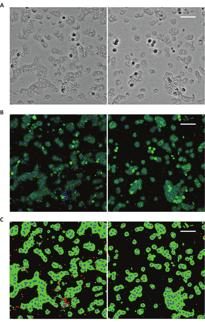 Isolation of Primary Rat Hepatocytes with Multiparameter Perfusion Control