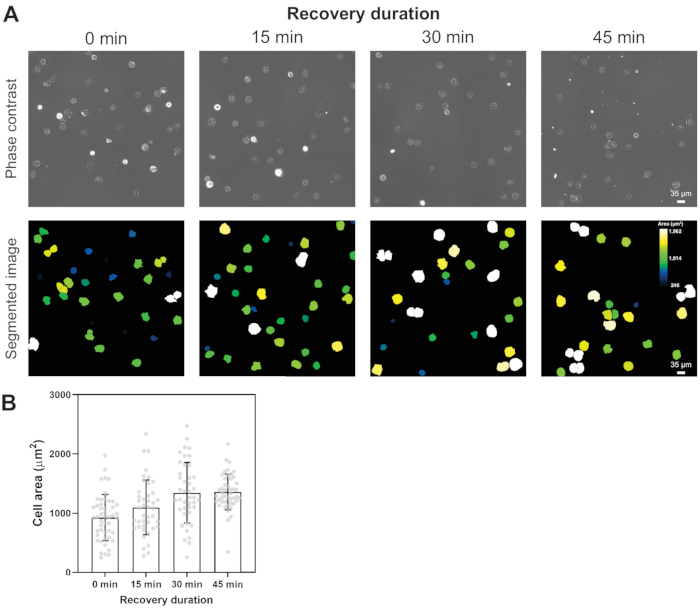 figure-results-2 Phase contrast and segmented images of cells with recovery durations; bar chart of cell area (µm²).