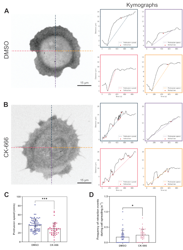 figure-results-5 Cell spreading analysis; microscopy images with kymographs, graphs on protrusion speed, retraction events.