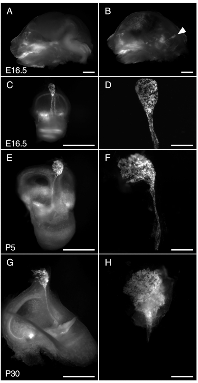 Sviluppo del cervello del topo, microscopia a fluorescenza, stadi da E16.5 a P30, imaging del tessuto neurale.